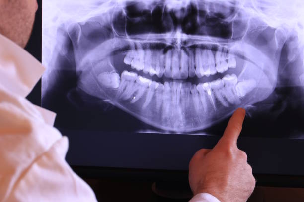 Best Emergency Dental Care for Broken or Chipped Teeth in Lido Beach, NY
