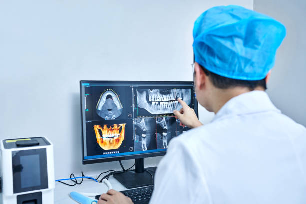 Best Emergency Treatment for Dental Infections or Abscesses in Lido Beach, NY
